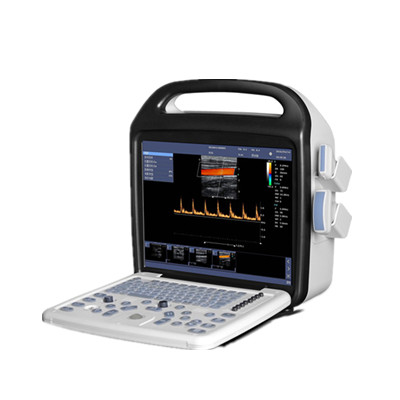 数字化便携式彩超